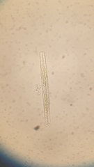 Fragilaria