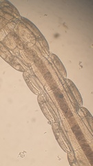 Orthocladiinae