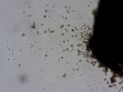 Chaenotheca hispidula