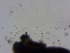 Mycocalicium subtile