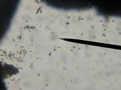 Mycocalicium subtile