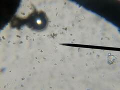 Mycocalicium subtile
