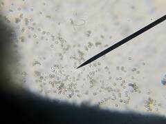 Chaenotheca hispidula