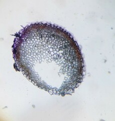 Subsecunda