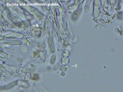 Hyphoderma