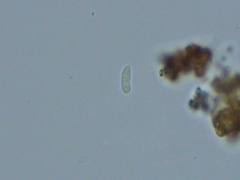 Hyphoderma