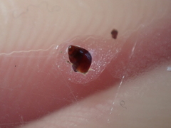Barleeia unifasciata