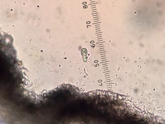 Arthonia radiata