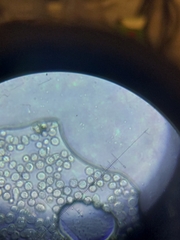 Aspergillus