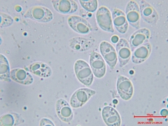 Collybiopsis