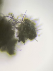 Lepraria finkii