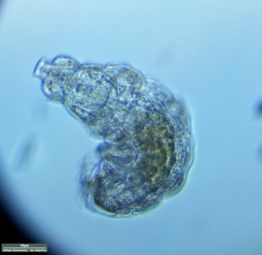 Tardigrada