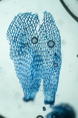 Sphagnum teres