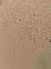 Beauveria bassiana