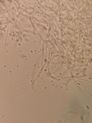Beauveria bassiana