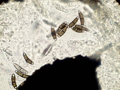 Chaetosphaerella phaeostroma