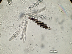 Chaetosphaerella phaeostroma