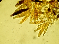 Chaetosphaerella phaeostroma