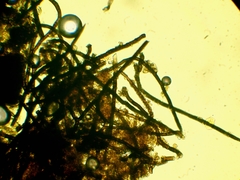 Chaetosphaerella phaeostroma