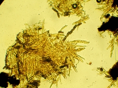 Chaetosphaerella phaeostroma