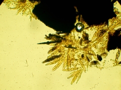 Chaetosphaerella phaeostroma