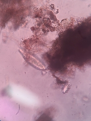 Spirotrichea