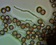 Didymium squamulosum