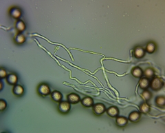Didymium squamulosum