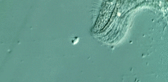 Loxodes striatus