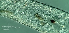 Loxodes striatus