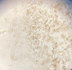 Diatrype decorticata