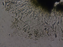 Cresponea chloroconia