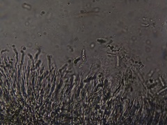 Cresponea chloroconia