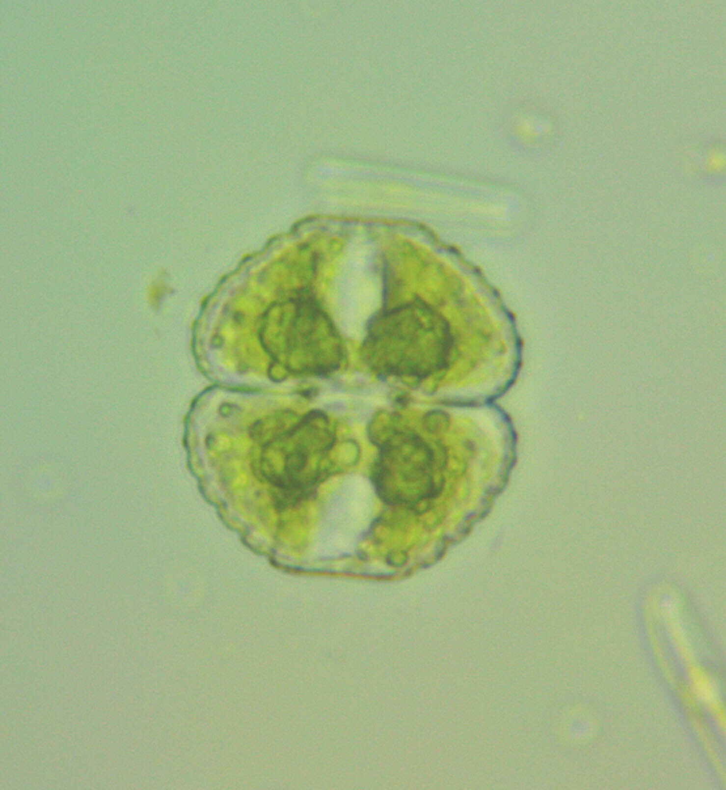 Cosmarium botrytis var. subtumidum