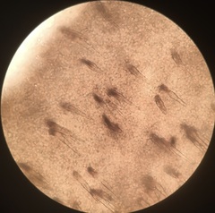 Resupinatus niger