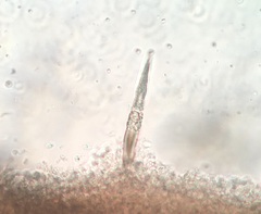 Resupinatus niger