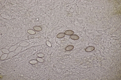 Ascobolus hawaiiensis