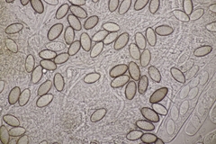Ascobolus hawaiiensis