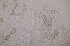 Ascobolus hawaiiensis