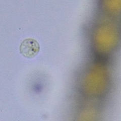 Protozoa