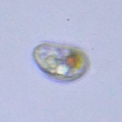 Protozoa