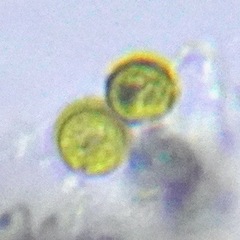 Protozoa