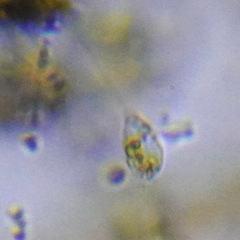 Protozoa