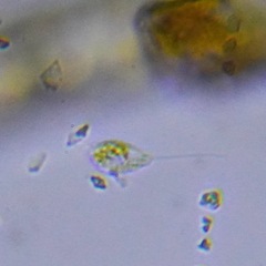 Protozoa