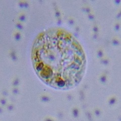 Protozoa