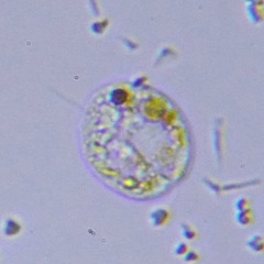 Protozoa