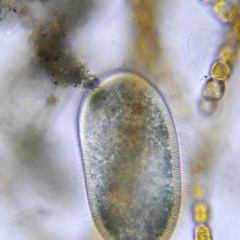 Ciliophora