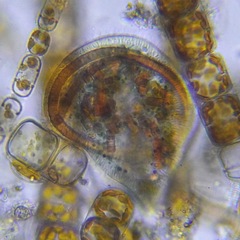 Ciliophora