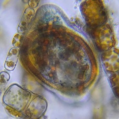 Ciliophora