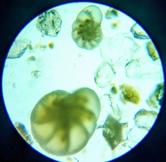Foraminifera